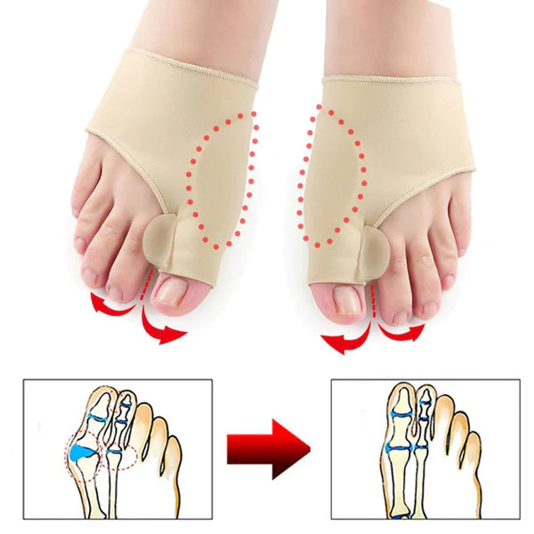 HALLUX®️ Corrector Ortopédico de Juanetes. ¡Alivio, Corrección y Comodidad Garantizada! ☑️