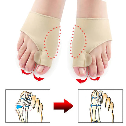 HALLUX®️ Corrector Ortopédico de Juanetes. ¡Alivio, Corrección y Comodidad Garantizada! ☑️